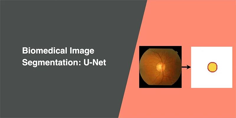 U-Net works with very few training images and yields more precise segmentation